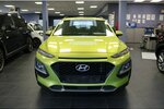 Hyundai Kona 1.0 T-GDI 115.043 km 11.980 € Euskirchen 53881